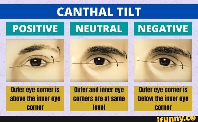 Canthal tilt illustration